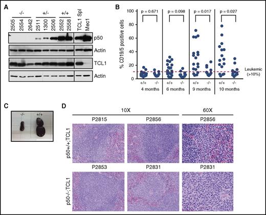 Figure 1. Peripheral blood (PB) and spleen leukemic burden is decreased in the p50−/−;TCL1 mice. (A) Immunoblots were performed in mouse spleen cell lysate from p50+/+, p50+/−, and p50−/− mice (all TCL1+). Spleen lysate from a TCL1-transgenic animal and lysate from the Mec1 cell line were used as a positive controls for TCL1 and p50, respectively. Actin is shown as a loading control. The line on the blots indicates where additional control lanes have been removed. (B) PB was monitored for the presence of CD19+/CD5+ leukemic cells starting at 4 months. Leukemia is defined as >10% CD19+/CD5+ cells. (C) Spleens were isolated from mice at time of sacrifice based on meeting early removal criteria. A representative image of spleens from littermate p50+/+;TCL1 and p50−/−;TCL1 animals is shown. (D) Hematoxylin-and-eosin (H&E) histology was performed on sections of spleens isolated from 4- to 7-month-old p50+/+;TCL1 and p50−/−;TCL1 animals (N = 6 per genotype). Representative images from each genotype at original magnification ×10 and ×60 are shown.