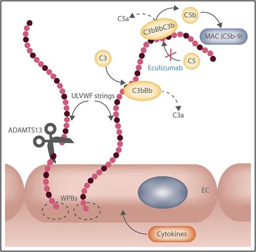 Linking von Willebrand factor (VWF) and the alternative complement pathway. Activation and amplification of the alternative complement pathway (AP) can occur on ultra-large (UL) VWF strings. The image depicts assembly of C3 convertase (C3bBb) and C5 convertase (C3bBbC3b) on endothelial cell (EC) secreted/anchored ULVWF multimeric strings, leading to the formation of copies of the membrane attack complex (MAC; C5b-9) that are potentially injurious to target (and host) cells. In individuals with ≥1 mutation/polymorphism promoting amplification of the AP (eg, by impairing the negative regulatory activity on C3 convertase by factor H, factor I, or CD46), acute aHUS episodes are likely. Normally, the VWF-cleaving protease ADAMTS13, released from EC cytoplasm, diminishes the brief time available for AP activation by the EC-secreted/anchored ULVWF strings. This proteolytic control mechanism is likely to be less effective if functional ADAMTS13 production is reduced even moderately (∼50% of normal ADAMTS13 activity is shown as cleavage of 1 of 2 ULVWF strings) and will be compromised further if the rate of ULVWF secretion/anchorage is increased by cytokines during inflammation or infection. Not shown are complement components regulating C3 convertase positively (properdin or factor P) or negatively (factors H and I and CD46) and platelet adherence to the ULVWF strings. C3b, Bb, C5b, activated C3, factor B, or C5, respectively; C3a, C5a, small cleavage products of C3 or C5; C5b-9, MAC complex composed of C5b, C6, C7, C8, and C9; WPB, Weibel-Palade body. Original figure prepared by Nancy A. Turner, Rice University. Professional illustration by Somersault18:24.