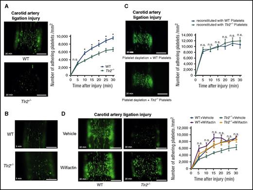 Figure 4. Reduced platelet deposition to the ligation injured carotid artery in Tlr2-deficient mice is independent of the platelet genotype, and the adhesion defect is rescued by VWF supplementation. (A) Imaging of DCF, 5- (and 6) carboxy-2’,7’-dichlorofluorescein diacetate (carboxy-DCFDA)-stained platelet deposits (green) to the ligation-injured common carotid artery in WT (top) and Tlr2−/− (bottom) mice 30 minutes after transient ligation; representative images and quantification (8-11 mice per group). (B) Representative images of DCF-stained platelet deposits (green) to the ligation-injured common carotid artery in WT (top) and Tlr2−/− (bottom) mice 5 minutes after transient ligation. (C) Platelet deposition in hGPIbα mice after platelet depletion and reconstitution with DCF stained WT (top) or Tlr2−/− platelets (bottom) 30 minutes after transient ligation; representative images and quantification (10 mice per group). (D) Imaging of DCF-stained platelet deposits (green) to the ligation-injured common carotid artery in WT and Tlr2−/− mice treated with sodium chloride (vehicle) or 153 mIU human VWF (Wilfactin) per mouse (6-10 mice per group). Scale bar, 200 µm. Representative images are shown. Mean ± SEM; repeated measurement ANOVA (mixed model), *P < .05. n.s., not significant.