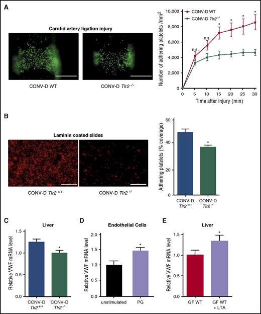 Figure 6. Impaired platelet deposition of colonized Tlr2−/− mice is restored by colonization of GF WT and GF Tlr2−/− mice. (A) Deposition of DCF, 5- (and 6) carboxy-2’,7’-dichlorofluorescein diacetate (carboxy-DCFDA)-stained platelets (green) to the ligation-injured common carotid artery in CONV-D WT (left) or CONV-D Tlr2−/− (right) mice 30 minutes after transient ligation (second generation offspring: mice were taken out from the germ-free environment and the second generation of these mice was analyzed; aged 8-14 weeks). Scale bar, 200 µm (8 mice per group). (B) Deposition of Rhodamin B–stained, washed platelets (red) from CONV-D WT (Tlr2+/+) or CONV-D Tlr2−/− mice to laminin. Representative images, scale bar, 100 µm; quadruplicate measurements (3 mice per group). (C) VWF mRNA expression in the livers of CONV-D WT (Tlr2+/+) or CONV-D Tlr2−/− mice (6-7 mice per group). (D) VWF mRNA expression of PG-stimulated (10 µg/mL, 2 h) HUVECs (N = 5-6 per group). (E) Hepatic VWF mRNA expression of GF C57BL/6 mice treated with lipoteichoic acid (LTA) (10 µg/mL) in drinking water for 7 days (6-7 mice per group). Mean ± SEM, independent-sample Student t tests or repeated measurement ANOVA (mixed model), *P < .05. n.s., not significant.