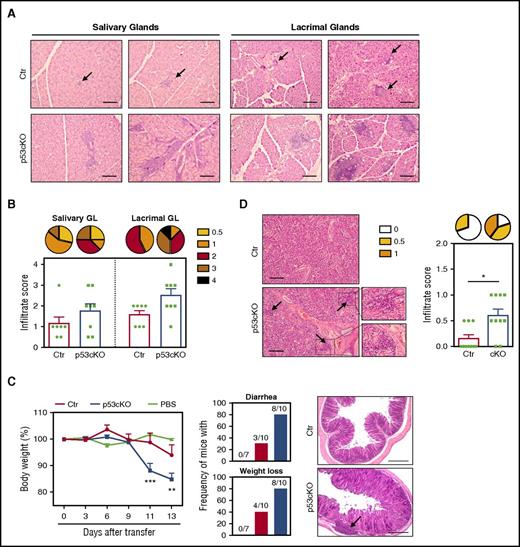 Figure 6. TEC-specific deletion of p53 affects the establishment of peripheral T-cell tolerance. (A) Representative analysis (H&E staining) of the salivary and lacrimal glands obtained from 6- to 7-month-old Ctr and p53cKO mice. (B) Histological scores of inflammatory infiltrates. Pie graphs show the frequency of inflammatory lesions according to their severity. (C) Thymocytes from 10-week-old Ctr (red line) and p53cKO (blue line) mice were intravenously transferred into Rag2−/− mice. As a control, Rag2−/− mice were treated with phosphate-buffered saline (green line). Change in the body weight of Rag2−/− recipients after thymocyte transfer (left). Incidence of diarrhea and weight loss, with the indicated number of recipient mice that develop symptoms (middle). Images show the histological analysis (H&E staining) of the colon of the Rag2−/− recipients 14 days after transfer (right). (D) Histological analysis and inflammatory score of the salivary glands. Pie graphs represent the frequency of inflammatory lesions according to their severity. Arrows in panels A, C, and D outline lymphocytic infiltrates. Results are presented as mean ± SEM. Scale bars, 100 μm. PBS, phosphate-buffered saline. *P < .05; **P < .01; ***P < .001.