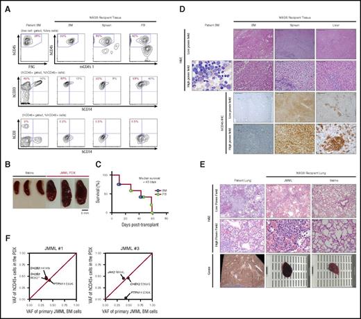 Figure 3. Establishment of PDX of JMML. (A) Immunophenotype of patient BM MNCs (left column) and tissues from a representative recipient mouse xenografted from the same patient (the percentages listed represent the percent of cells within the gate described above each plot; hCD45, human CD45; mCD45.1, mouse CD45.1). (B) Splenomegaly in JMML PDX mice when compared with spleens from NSGS mice injected with saline. (C) Kaplan-Meier survival curve of recipient NSGS mice engrafted with BM MNCs (n = 6) or PB MNCs (n = 6) from JMML patients (n = 4). (D) H&E and immunohistochemistry for hCD45+ cells in patient BM and the BM, spleen, and liver of xenografted BM MNCs from the same patient (scale bars for low-power field: 200 μm, original magnification ×100; scale bars for high-power field: 50 μm, original magnification ×1600). (E) H&E of 1 illustrative patient with lung hemorrhage at autopsy and the corresponding JMML PDX and saline-injected mouse for control (scale bars for low-power field: 200 μm, original magnification ×100; scale bars for high-power field: 50 μm, original magnification ×1600). (F) VAF of genomic DNA from BM MNCs from JMML patients (x-axis) and corresponding purified hCD45+ cells from engrafted NSGS mice at end stage (y-axis).