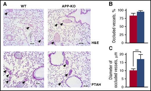 Figure 4. Analysis of pulmonary thromboembolism. (A) Representative lung histology images on staining with hematoxylin/eosin (H&E) and phosphotungstic acid–hematoxylin (PTAH). Arrows indicate occluded vessels. Quantification of the percentage of occluded vessels is reported in (B), and analysis of the mean diameter of occluded vessels is reported in (C). Data have been collected by examining 10 microscopic fields for each lung section, prepared from 5 different animals, and are presented as mean ± SEM. **P < .01.