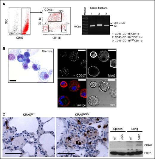 Figure 2. CD207 expression in lung CD11c+ cells driven by KRASG12D. (A) Polymerase chain reaction (PCR) detection of the recombined KRASG12D (Lox-G12D) allele in sorted hematopoietic populations from the AdCre/KRASG12D lung. The recombined Lox-G12D allele is clearly detected in CD45+CD11blowCD11c+ cells (population 2) at a similar level to the KRASWT (WT) allele. (B) Left, Giemsa staining of sorted CD45+CD11blowCD11c+ cells. This population is composed of small cells showing basophilic cytoplasm with relatively high nuclear/cytoplasmic (N/C) ratios, and larger macrophage-like cells. Scale bar, 10 μm. Right, confocal imaging of enriched CD11c+ cells stained for CD207 (green) and MAC2 (red). Reticular CD207 staining in cytoplasm and variable levels of membranous/cytoplasmic MAC2 staining detected in most cells. Scale bar, 10 μm. (C) CD207 expression in the AdCre/KRASG12D lung detected by IHC (top) and immunoblotting (bottom). Scale bars (top panels), 62.5 μm. DIC, differential interference contrast; SSC, side scatter.