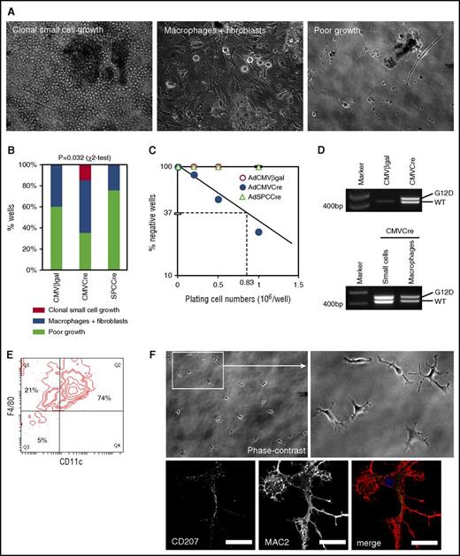 Figure 4. Limiting dilution culture of lung cells induced to express KRASG12D in vitro. (A) Phase-contrast images of AdCMVCre-infected KRASLSL-G12D lung cell cultures (2 × 105 per well plating). Cultures developing floating cell clusters composed of small round cells (left), macrophage-like large round cells with fibroblasts (middle), and poorly growing cells (right), are indicated. Original magnification ×200. (B) Comparison between AdCMVCre-infected and control (AdCMVβgal or AdSPCCre-infected) cultures with regard to the development of floating round cell clusters and macrophage-like cells. A total of 20 wells plated at 2 × 105 per well (5 wells per mouse × 4 KRASLSL-G12D mice) for each infection were analyzed at 4 weeks in culture. Floating round cell cluster development was detected only in AdCMVCre-infected cultures (3 of 20 wells). Statistical significance of the difference was confirmed by χ2 test. (C) Limiting dilution analysis to determine the frequency of the cells initiating the development of floating round cell clusters. The data obtained from adenovirus-infected cultures plated at 2 × 105 per well (20 wells), 5 × 105 per well (12 wells), or 1 × 106 per well (8 wells), and floating cell cluster formation was determined at 4 weeks in culture. The frequency was estimated as 1 in 0.83 × 106 AdCMVCre-infected cells. (D) PCR detection of recombination of the KRASG12D allele in AdCMVCre or AdCMVβgal-infected cultures (top), and in small round cells forming floating cell clusters or macrophage-like large cells obtained from AdCMVCre-infected cultures (bottom). The recombined KRASG12D allele (Lox-G12D) was detected in both floating small cells and large macrophage-like cells developing in the AdCre-infected culture, at a similar level to the KRASWT (WT) allele. (E) Flow cytometry analysis of surface CD11c and F4/80 expression on small cells forming floating clusters at 7 weeks in the AdCMVCre-infected culture. A representative contour plot for CD11c and F4/80 is indicated. (F) Representative phase-contrast (top, original magnification ×200) and CD207/MAC2 immunofluorescence (bottom, by confocal laser scanning microscopy) images of replated cluster cells. Floating cells at 7 weeks in the AdCMVCre-infected culture were replated on coverslips, and imaged at 48 hours following replating. Scale bar, 20 μm (confocal images).