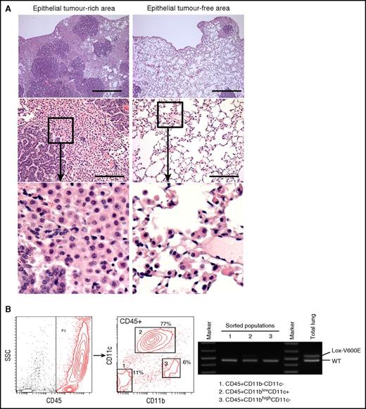 Figure 6. Characterization of the AdCre/BRAFV600E lung. (A) H&E staining of lung sections from AdCre/BRAFV600E mice. Low (top) and high (middle) magnification images focusing on epithelial tumor (papillary adenoma)-rich (left) and epithelial tumor-free (right) areas are indicated. Enlarged images for the boxed area in the middle panel are indicated at the bottom. Scale bars represent 0.5 mm (top) and 125 μm (middle). (B) PCR detection of the recombined BRAFV600E (Lox-V600E) allele in sorted hematopoietic populations from the AdCre/BRAFV600E lung. The recombined Lox-V600E allele was only faintly detected in CD45+CD11blow-intCD11c+ cells (population 2), and was much weaker than the BRAFWT (WT) allele. No recombination of the allele was detected in 2 other populations.