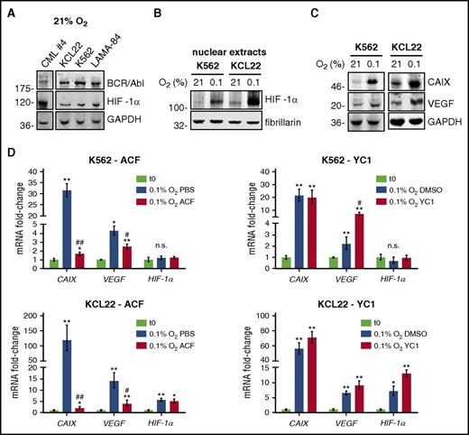 Figure 1. HIF-1α was expressed in CML cells and ACF inhibited the increase of HIF-1α target genes in low oxygen. (A) Primary (CML case 4) or CML cell lines were lysed and total cell lysates subjected to immunoblotting with the indicated antibodies. Glyceraldehyde-3-phosphate dehydrogenase (GAPDH) expression was used as a loading control. Migration of molecular weight markers is indicated on the left (in kilodaltons). One representative experiment of 3 is shown. (B-C) Cells were incubated at the indicated oxygen concentrations for 3 days. (B) Nuclear lysates were subjected to immunoblotting with the indicated antibodies. Fibrillarin was used to verify the equalization of protein loading. Migration of molecular weight markers is indicated on the left (in kilodaltons). One representative experiment of 3 is shown. (C) Total cell lysates were subjected to immunoblotting with the indicated antibodies. GAPDH was used to verify equalization of protein loading. Migration of molecular weight markers is indicated on the left (in kilodaltons). One representative experiment of 3 is shown. (D) Cells were incubated for 2 days at 0.1% O2, in the presence of 5 µM ACF or 50 µM YC1, or their solvents (PBS or DMSO, respectively). CAIX, VEGF, or HIF-1α mRNA were measured by q-PCR. Data were normalized with respect to β-actin and expressed as fold-change with respect to the values obtained for time 0 (t0) cells. Values represent mean ± standard deviation (S.D.) of 3 independent experiments, each carried out in triplicate; vs t0: *P ≤ .05, **P ≤ .01; vs control (PBS or DMSO) 0.1% O2: #P ≤ .05, ##P ≤ .01; either comparison: n.s., not significant.