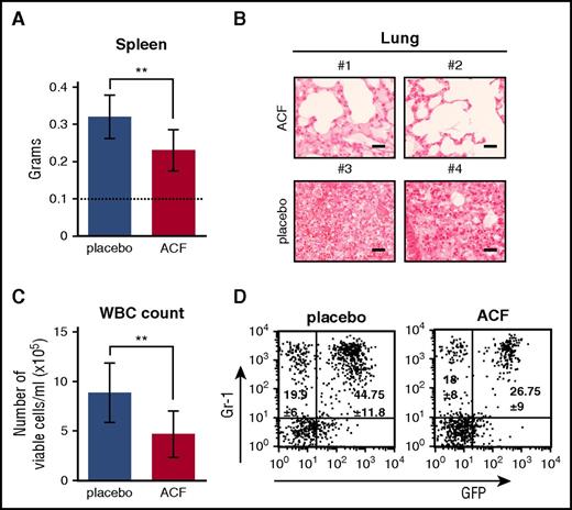 Figure 6. ACF reduced CML development in vivo. CML mice were treated daily for 10 days with ACF or placebo and euthanized after 1 additional day. (A) Spleen weight; dotted line: non-CML mice. Data are mean ± S.D. of 8 mice per experimental variant; **P ≤ .01. (B) Hematoxylin-stained lung sections (original magnification ×40) from 2 representative mice per experimental variant (scale bar, 25 µm). (C) Total PB WBCs. Data are mean ± S.D. from 8 mice per experimental variant; **P ≤ .01. (D) Percentage of GFP+ (leukemic) or GFP− (nonleukemic) myeloid cells (Gr-1+) in PB. Plots show data from 1 representative mouse per experimental variant. Means ± S.D. from 8 mice per experimental variant are reported inside the plots.