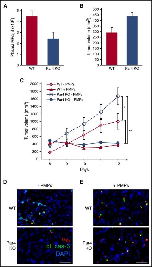 Figure 5. Plasma MPs and tumor growth in Par4 KO mice. (A) Plasma MPs from WT and Par4 KO mice were analyzed by nanoparticle tracking, and are shown ± SEM (n = 6); P < .03. (B) A total of 1 × 106 LLC cells were seeded in the flanks of WT and Par4 KO mice, and tumor volumes were measured 8 days after seeding, shown ± SEM (n = 6); P < .03. (C) LLC tumors were seeded as in panel B, and 1 × 1010 freshly isolated PMPs were transfused in the tail vein every 24 hours beginning at day 8 as indicated. Tumor volumes were measured daily, and are shown ± SEM (n = 6); *P < .03; **P < .002. (D) Tumors from panel C were resected, fixed, and processed for IHC with antibodies to murine CD41 (αIIb integrin, red) to label endogenous PMPs, and cleaved caspase-3 (green); DAPI stain is shown in blue. (E) Tumor sections from panel C stained with antibodies to human CD41 (αIIb integrin, red) to label transfused PMPs, cleaved caspase-3 (cl. cas-3, green), and DAPI (blue). Bars, 15 μm.
