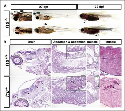 Figure 4. Loss of F10 results in late-onset hemorrhage at multiple sites. (A) Grossly visible hemorrhaging occurred in f10−/− mutant fish as early as 27 dpf, but not in wild-type or heterozygous siblings. Massive hemorrhages were observed in the brain, muscle, gill filaments, and abdomen as shown in viable f10−/− mutants. (B) Hematoxylin and eosin stained histologic sections of f10−/− mutants confirmed substantial intracranial, abdominal, and intramuscular hemorrhage at 27 dpf. Arrows indicate sites of hemorrhage. Locations of magnified insets (×4) are indicated by the smaller boxes in the same panel. Anterior is toward the left, and dorsal is toward the top. Scale bar, 100 µm. ad, abdomen; fb, forebrain; gf, gill filament; hb, hindbrain; mb, midbrain.
