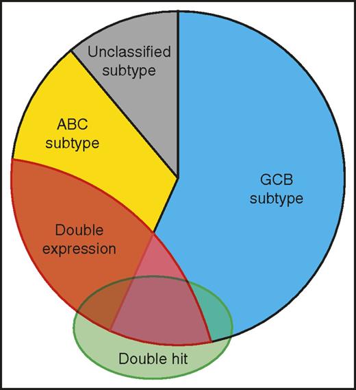 Figure 2. Myc and DLBCL. Approximately one-third of DLBCLs are positive for myc and bcl-2 by immunohistochemistry (double expressor); most of these occur in ABC DLBCL. The new WHO category of high-grade B-cell lymphoma with myc and bcl-2 and/or bcl-6 rearrangements (double hit) usually, but not always, falls in the double-expressor group, but in the GCB subtype. Additionally, morphology of this group may include Burkitt-like lymphoma.