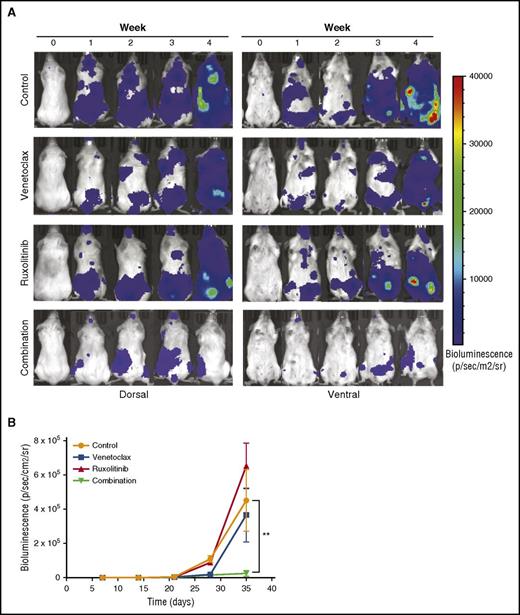 Figure 7. Inhibition of JAK/STAT and BCL2 signaling by ruxolitinib and venetoclax reduces tumor burden in an AML xenograft mouse model. Twenty-four NSG mice engrafted with luciferase expressing MOLM-13 cells were treated with vehicle, venetoclax (25 mg/kg, intraperitoneally), ruxolitinib (50 mg/kg, by mouth), or both for 3 weeks. (A) Each row represents an individual mouse from each treatment group. Bioluminescence images shown before the start of the treatment, each week of the treatment period, and 1 week after the end of the treatment. (B) Mean bioluminescence of all mice in each treatment group (n = 6 for each group) recorded before the start of the treatment, during the 3-week treatment period, and 1 week after the end of the treatment. Error bars represent standard error of the mean. Statistically significant difference is represented by asterisk, which signify **P < .01 by Mann-Whitney test.