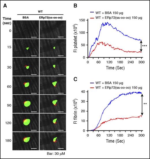 Figure 6. Recombinant ERp72(ss-oo-oo) protein inhibits platelet accumulation and fibrin deposition in wild-type mice. Wild-type (WT) C57BL/6 mice were infused with ERp72 (ss-oo-oo) or bovine serum albumin (BSA; control) (150 μg per mouse), followed by cremaster arteriole injury. Platelets and fibrin were detected using anti-CD41 F(ab)2 conjugated to Alexa Fluor 488 and anti–fibrin antibody conjugated to Alexa Fluor 647. (A) Representative fluorescence images of intravital microscopy for platelet accumulation (green) and fibrin deposition (red). Original magnification ×64. Scale bars, 30 μm. Median fluorescent intensities (FIs) of anti–CD41 antibodies (platelets) (B) and anti–fibrin antibody (C) with the area under curve were analyzed using a Mann-Whitney rank-sum test; **P < .01; ***P < .001. The data were obtained from 30 thrombi in 3 mice for each experimental condition.