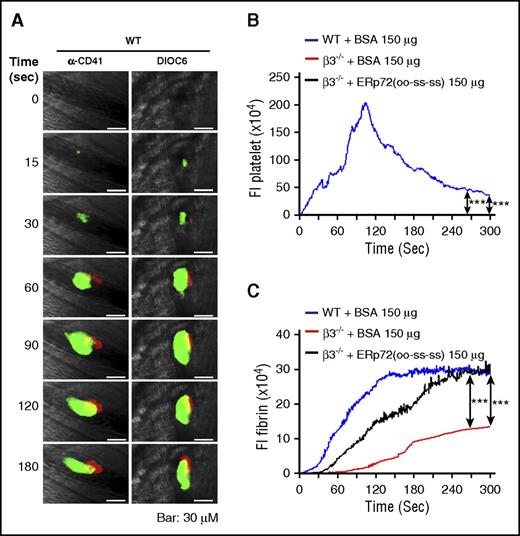 Figure 7. Recombinant ERp72(oo-ss-ss) protein directly enhances fibrin deposition. (A) Cremaster arteriole injury was induced in wild-type mice after they received intravenous injection of anti–fibrin antibodies conjugated to Alexa Fluor 647, with anti-CD41 F(ab)2 conjugated to Alexa Fluor 488 or 3′-dihexyloxacarbocyanine iodide (DIOC6) (2.5 μL of a 100 μM solution per gram of body weight). Representative images for platelet accumulation visualized by these 2 methods (green) and fibrin formation (red). The total original magnification is ×64. Scale bar, 30 μm. (B) Wild-type mice and β3−/− mice received intravenous infusion of ERp72(oo-ss-ss) or BSA (control) (150 μg per mouse) as indicated, followed by cremaster arteriole injury. Platelets and fibrin formation were detected using DIOC6 and anti–fibrin antibody conjugated to Alexa Fluor 647. Median fluorescence intensities (FIs) of platelets (B) and fibrin (C) with the area under curve analyzed using a Kruskal-Wallis test. Only significant differences are shown; ***P < .001. The data were obtained from 40 thrombi in 5 mice for each experimental condition.