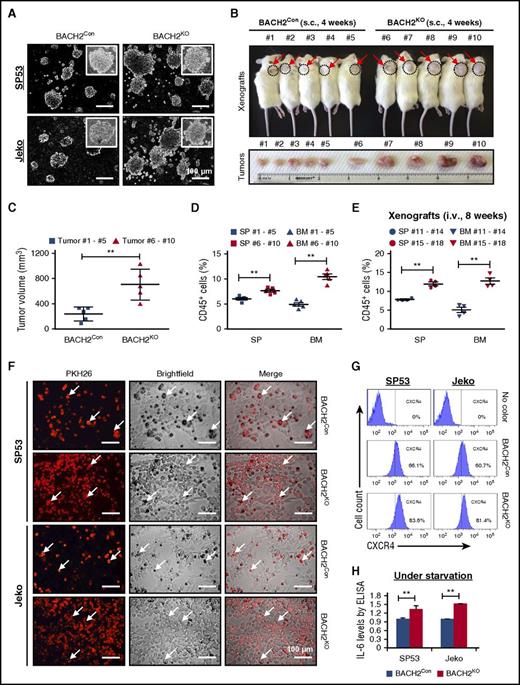Figure 2. BACH2 deletion contributes to increased colony-formation abilities and increases cell adhesion. (A) Representative colonies of BACH2KO and BACH2Con MCL cells in MethoCult medium were photographed under a microscope. Scale bar, 100 μm. (B) BACH2KO or BACH2Con SP53 MCL cells (3.5 × 106) were subcutaneously (s.c.) injected into NOD/SCID mice (n = 10). Mice 1 to 5 were injected with BACH2Con cells, and mice 6 to 10 were injected with BACH2KO cells. Xenografts were sacrificed 4 weeks postinjection. Dotted circles represent the area of subcutaneous tumors (top). Tumors were isolated and photographed against an inch ruler (bottom). (C) The size of the tumors in each group was measured. The results are shown as the mean ± SD. **P < .01 (vs control xenografts; Student t test). (D) Human leukocyte cells were isolated from the spleen (SP) and bone marrow (BM) using anti–human CD45-MicroBeads, and the number of CD45+ cells was counted using trypan blue staining. The percentage of CD45+ cells in each organ was calculated, and data are presented as the mean ± SD. **P < .01 (vs control xenografts; Student t test). (E) BACH2KO SP53 cells or control cells (3 × 106) were IV injected (i.v.) into NOD/SCID mice (n = 8). Mice 11 to 14 were injected with BACH2Con cells, and mice 15 to 18 were injected with BACH2KO cells. Xenografts were sacrificed 8 weeks postinjection. SP and BM were collected and stained for human leukocyte cells using anti–human CD45 antibody. Samples were then analyzed for CD45+ cells using FACS analysis. The percentage of CD45+ cells in each organ was calculated, and data are presented as the mean ± SD. **P < .01 (vs control xenografts; Student t test). (F) Representative microscopic images of adherent MCL cells in a coculture setting. Either BACH2KO or BACH2Con MCL cells were stained with PKH26 prior to seeding onto a preestablished monolayer of HS5 BMSCs. Scale bar, 100 μm. The arrows point to the representative MCL cells adhered to bone marrow stromal cells. (G) CXCR4 levels in BACH2KO or BACH2Con cells were analyzed by flow cytometry, the percentage of CXCR4+ cells in the population is indicated. (H) BACH2KO or BACH2Con MCL cells were serum starved for 48 hours. IL-6 levels were measured using enzyme-linked immunosorbent assay. The colorimetric values in the BACH2KO cells were normalized to the control values. The results are shown as the mean ± SD from 3 independent experiments. **P < .01 (vs control cells; Student t test).