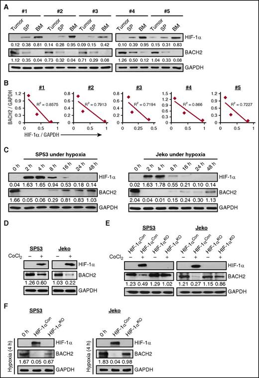Figure 4. HIF-1α negatively correlates with BACH2 expression under hypoxia. (A) Immunoblots of CD45+ human cells for HIF-1α and BACH2 in subcutaneous tumors, SP, or BM from xenograft mice bearing MCL cells (n = 5, #1-#5). GAPDH was used as a loading control. The normalized values for HIF-1α and BACH2 in each lane are indicated. (B) Linear regression analysis of the relative BACH2 and HIF-1α expression levels based on densitometry analyses of immunoblots shown in panel A. R2 values of each xenograft are indicated. (C) MCL cells were cultured under hypoxia (at 1% O2) at the indicated times. HIF-1α and BACH2 levels were measured by immunoblotting with GAPDH as a loading control. The normalized values for HIF-1α and BACH2 in each lane are indicated. (D) Immunoblots of MCL cells for HIF-1α and BACH2 in the presence or absence of CoCl2 treatment (200 μmol/L) for 24 h. The BACH2/GAPDH ratios are indicated under each lane. (E) CRISPR-Cas9–mediated HIF-1αKO MCL cells were generated with mock-transfected cells (HIF-1αCon) as a control. HIF-1αKO or HIF-1αCon cells were incubated in the presence or absence of CoCl2 for 24 hours. HIF-1α and BACH2 levels were detected by immunoblotting. (F) HIF-1αKO MCL cells were cultured under hypoxia for 4 hours with HIF-1αCon cells as a control. HIF-1α and BACH2 levels were detected by immunoblotting.
