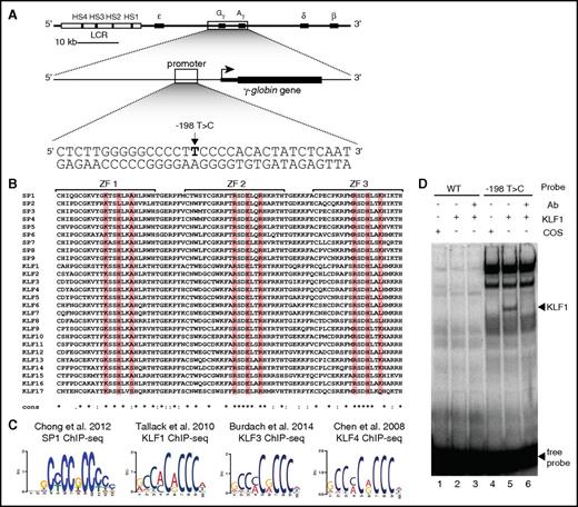 Figure 1. KLF1 binds to and activates the −198T>C γ-globin promoter in vitro. (A) The organization of the human β-globin locus (chromosome 11). The β-like globin genes are indicated by black boxes with their conventional gene symbols indicated above them. The locus-control region (LCR) is represented as a rectangle, with the DNase I hypersensitive sites (HS) within the LCR being represented by black boxes (HS1-4). The British HPFH (−198T>C) mutation in the promoter of the γ-globin gene is also depicted. (B) Aligned protein sequences of the 3 zinc finger (ZF) DNA-binding domains of all members of the SP/KLF family of transcription factors. Highlighted are residues −1, +3, and +6 of each zinc finger, which are responsible for making contact to DNA. (C) In vivo binding motifs of transcription factors SP1,18 KLF1,15 KLF3,16 and KLF417 as determined by ChIP-Seq. (D) EMSA (electrophoretic mobility shift assay) showing that KLF1 can bind in vitro to a −198T>C probe but fails to bind to a WT probe containing the −198 region of the γ-globin promoter. Lanes 1 to 3 contain the WT probe for the −198 site (−209 to −187 bp) and lanes 4 to 6 contain the HPFH −198T>C mutant probe. Lanes 1 and 4 contain nuclear extracts from COS cells transfected with a pcDNA3 empty vector. Lanes 2 to 3 and 5 to 6 contain nuclear extracts from COS cells overexpressing KLF1. Binding of KLF1 to the −198T>C HPFH mutant probe can be observed in lane 5, with a supershift of KLF1 with an anti-KLF1 antibody in lane 6. Ab, antibody; WT, wild type.