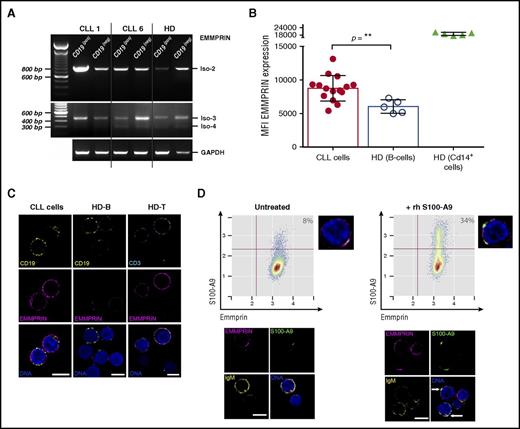 Figure 4. EMMPRIN expression in CLL cells and S100-A9 binding in vitro. (A) Reverse-transcription polymerase chain reaction analysis of EMMPRIN mRNA isoforms in CLL. EMMPRIN mRNA isoforms 1 to 4 expression was evaluated in MACS-sorted B lymphocytes (CD19+) and non-B cells (CD19−) as described by Oppezzo et al.18 EMMPRIN isoform 2 is expressed in leukemic B cells at higher levels than in normal B cells, whereas isoforms 3 and 4 are also expressed but at basal levels. (B) Flow cytometry analysis of EMMPRIN protein levels in B lymphocytes. Median fluorescence intensity analysis of EMMPRIN staining in CLL and HD B cells reveals higher levels of EMMPRIN staining in CLL B cells (mean, 8.751; n = 15) compared with normal B cells (mean, 5.964; n = 5; Mann-Whitney test, P = .0037). MFI, mean fluorescence intensity. (C) EMMPRIN in situ immunostaining. Direct in situ immunolocalization of EMMPRIN (magenta) shows higher staining intensities in CLL B cells compared with their normal counterparts (CD19+ in yellow). EMMPRIN staining in normal T cells (CD3+ in cyan) was assessed as positive control. Single confocal planes are shown; deconvolution was performed with Huygens Essential 4.5 (Scientific Volume Imaging, Hilversum, The Netherlands; http://svi.nl). Scale bar, 5 µm. (D) rhS100-A9 B-cell CLL in vitro binding assay. The binding ability of rhS100-A9 (green) on B-cell CLL cells (IgM+ in yellow) expressing EMMPRIN (magenta) was evaluated on incubation of 106 cells with 5 µg/mL for 1 hour at 37°C. An increase from basal 8% to 34% of S100-A9+ cells was found. Flow cytometry analysis was performed with R/Bioconductor. Confocal microscopy analysis showed an increase in S100-A9 immunostaining and suggested colocalization of rhS100-A9 with EMMPRIN receptor, shown in white in the overlaid images (arrows). Deconvolved single confocal planes are shown. Scale bar, 5 µm.