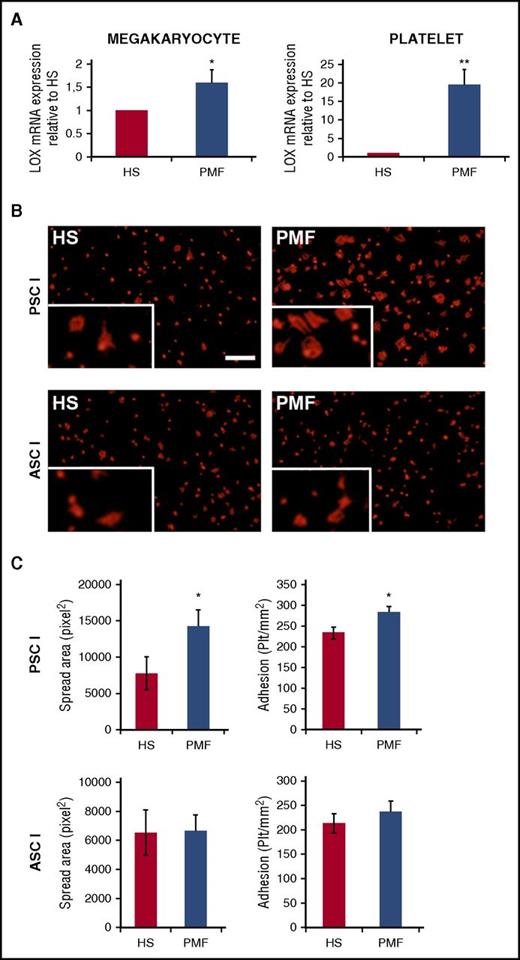 Figure 1. Quantitative reverse-transcriptase polymerase chain reaction analysis of LOX in peripheral blood platelets and megakaryocytes differentiated from control HSs and patients with PMF. (A) Equal numbers of cells were evaluated in the experimental groups, and values were normalized to GAPDH messenger RNA (mRNA) and expressed relative to HSs. Data are expressed as mean ± standard deviation (SD) of 10 samples from patients with PMF and 5 from HSs. *P < .05, **P < .01. (B) An equal number of washed platelets from peripheral blood of HSs or patients with PMF were plated on pepsinated monomeric type I collagen (PSCI) or triple helical native acid soluble type I collagen (ASCI). Adherent platelets were fixed and stained with anti β-actin antibody (red). Scale bar, 50 µm. (C) Platelets (plt) were counted and expressed as platelets per mm2. Spread area was measured using Olympus LCmicro software and expressed as pixels. Data of adhesion to monomeric collagen (top bars) or fibrillar collagen (lower bars) are expressed as mean ± SD. *P < .05. Supplemental Methods provides additional details on procedures and statistics.