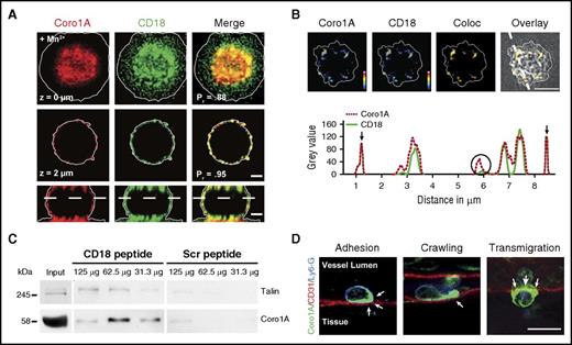 Figure 1. Role of Coro1A in integrin biology. CSRM (A) and STED nanoscopy (B) of murine PMN upon Mn2+-induced adhesion to fibrinogen. (A) Coro1A (red), CD18 (green), and merge (yellow) in 2 different z-stack positions and in 1 orthogonal layer. Scale bar, 1 µm. Colocalization was calculated using the Pearson’s correlation coefficient (Pr). (B) Coro1A and CD18 in pseudocolors (colocalization in yellow) at surface proximal layer demonstrated by reflection pattern shown in transmission picture and intensity profile along segmented line. Partial (open circle) and complete (arrows) colocalization. Color scale, heat map. Scale bar, 5 μm. (C) Pull-down assay using synthesized peptides of the cytoplasmic tail of CD18 or scrambled control peptides incubated with different protein amounts of lysates of primary human PMNs (n = 3). (D) Subcellular localization of Coro1A (arrows) during trauma-induced PMN trafficking, that is, adhesion, intraluminal crawling, and transmigration in cremaster muscle whole mounts. Coro1A (green), CD31 (red), Ly6-G (blue). Scale bar, 10 µm. Coloc, colocalization; Scr, scrambled control peptides.