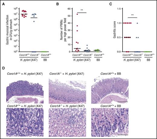 Figure 6. Genetic absence of Coro1A significantly reduces the severity of H pylori–induced gastritis. (A-D) Coro1A+/+ and Coro1A−/− mice were infected with H pylori X47 or inoculated with BB medium. H pylori–inoculated Coro1A+/+ mice (solid squares, n = 11) and Coro1A−/− mice (solid triangles, n = 12), BB medium–inoculated Coro1+/+ mice (solid circles, n = 10). (A) Colonization of H pylori (log CFUs per gram of gastric tissue). (B) Number of PMNs in the high power field. (C) Gastritis scores.26 (D) Representative histological sections of gastric mucosa stained with hematoxylin and eosin. Scale bars, 400 µm (top) and 100 µm (bottom). **P < .001.