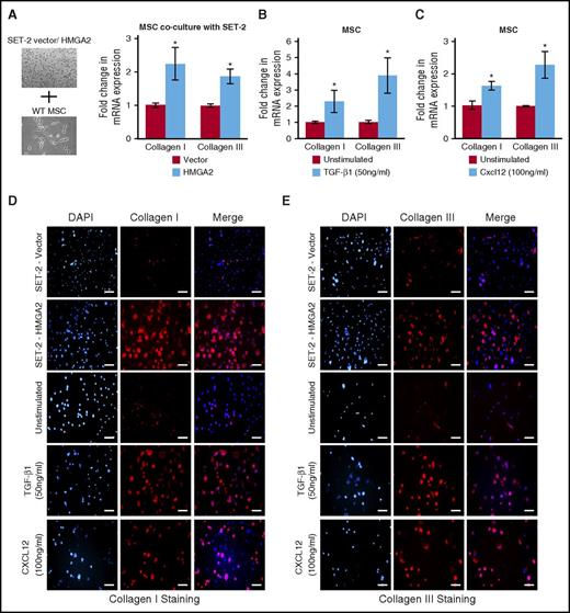Figure 7. Expression of Hmga2 induces collagen deposition in the BM mesenchymal stromal cells. (A) A scheme for the coculture system is shown on the left. MSC culture was first established from the BM of WT mice. MSCs were then re-plated and cultured for 72 hours before SET-2 cells expressing vector or HMGA2 were placed on top of MSCs and cultured for another 72 hours. SET-2 cells were then removed from MSCs. RNA was isolated from the MSCs. RT-qPCR showed increased collagen I and III mRNA expression in MSCs cocultured with SET-2 cells overexpressing HMGA2. Data from 4 independent experiments are shown in bar graphs as mean ± SEM. Stimulation with (B) TGF-β1 (50 ng/mL) or (C) Cxcl12 (100 ng/mL) showed increase in collagen I and III mRNA expression in MSCs compared with unstimulated MSCs. The mRNA expression was assessed by RT-qPCR and normalized by Gapdh. Data from 4 independent experiments are shown in bar graphs as mean ± SEM. (D-E) Immunofluorescence images showing increased expression of collagen I and collagen III in MSCs cocultured with SET-2 cells overexpressing HMGA2 compared with vector expressing SET-2 cells. Stimulation with TGF-β1 (50 ng/mL) or Cxcl12 (100 ng/mL) also increased collagen I and III expression in MSCs. Scale bars, 100 µm. *P < .05.