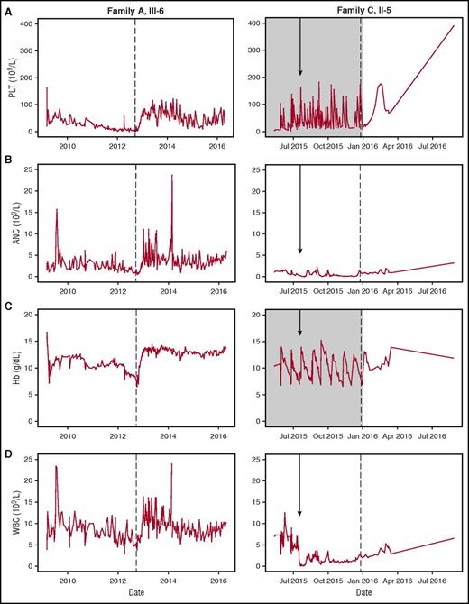 Figure 2. Clinical response to romiplostim. Trilineage response to romiplostim therapy. (A) PLT, (B) ANC, (C) Hb, and (D) WBC counts are shown for affected individuals: Family A, III-6 and Family C, II-5. Arrow indicates date of BMT. Gray shading indicates timeframe of platelet and erythrocyte transfusion dependence. Dotted line indicates initiation of romiplostim therapy. Note difference in time scale (x-axis) between left and right panels.
