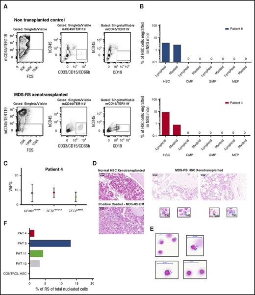 Figure 4. In vivo reconstitution of RSs from MDS-RS HSCs. (A) Representative FACS gating strategy used for analysis of human myeloid (CD33/CD66b/CD15+) and lymphoid (CD19+) engraftment in xenotransplanted nonobsese diabetic/LtSz-scid IL2Rγc−/− (NSG) mice transplanted with healthy or SF3B1-mutated MDS-RS human stem and progenitor cells. The number of purified HSCs, CMPs, GMPs, and MEPs transplanted into NSG mice was according to their relative ratios in the patient BM. Patient 4: 1400, 5000, 21 000, and 1400 cells; patient 5: 25 000, 55 000, 49 300, and 25 200 cells, respectively. Top panels show gating in a nontransplanted NSG mice (negative control); bottom panels show analysis in an NSG mouse transplanted with MDS-RS HSCs from patient 4. (B) In vivo human B-lymphoid and myeloid engraftment in BM of NSG mice 20 to 22 weeks posttransplantation of FACS-purified HSCs or indicated progenitors (mean values from 2 or 3 mice per cell population per patient) from 2 SF3B1-mutated MDS-RS. (C) Mean VAF in myeloid cells derived from patient 4 HSCs transplanted in NSG mice. (D) Prussian blue stains from sections of paraffin-embedded BM tissue from NSG mice with human reconstitution from healthy (top left) or SF3B1-mutated MDS-RS HSCs (top right; patient 5). The bottom left panel shows positive control from BM of MDS-RS patient; scale bar, 50 μm. The bottom right panel shows characteristic Prussian blue–positive cells in BM of NSG mice transplanted with MDS-RS HSCs from patient 5; scale bar, 10 μm. (E) Cytospins of erythroid cells purified from BM of patient 5 (supplemental Figure 6), stained with Prussian blue; scale bar, 20 μm. (F) Percentage of RSs of total nucleated BM cells in BM of NSG mice transplanted with purified HSCs. PAT, patient.
