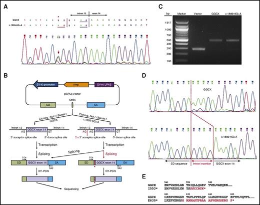 Figure 1. The intronic mutation c.1889-6G>A affects GGCX splicing. (A) Chromatograms of the sequencing results of the patient’s genomic DNA near the junction of intron 13 and exon 14. A heterozygous mutation of c.1889-6G>A was identified; it is indicated by an asterisk and an arrow. The splicing-acceptor site (AG) of the wild-type and the mutant sequences is underlined. (B) Schematic diagram of the minigene splicing assay. Polymerase chain reaction (PCR) fragments of exon 14 flanked by intronic sequences were cloned into a pSPL3 minigene splicing assay vector. These constructs were transfected into HEK293 cells, and the splicing products were amplified by reverse transcription polymerase chain reaction (RT-PCR) for sequencing analysis. (C) DNA electrophoresis of the splicing products from the empty vector, the wild-type GGCX, and the c.1889-6G>A mutant. (D) Chromatograms of the sequencing results of the splicing products of the wild-type GGCX and the c.1889-6G>A mutant. Intronic insertion sequences are indicated in red. (E) Amino acid sequences of the C-terminus of the 2 identified GGCX truncation mutants. Additional sequences added to the C-terminus of GGCX due to reading frame shift are highlighted in red. bp, base pair; LPAS, late poly(A) signal; SA, splice acceptor; SD, splice donor; SV40, simian virus 40.