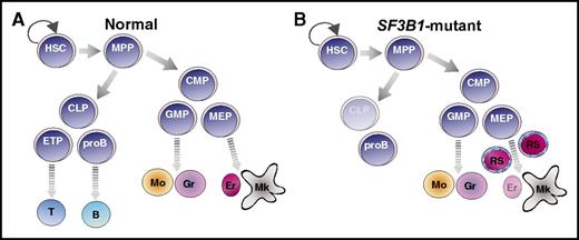 SF3B1 mutations in the hematopoietic hierarchy of MDS-RS. Cartoon illustration of normal (A) and SF3B1-mutant (B) MDS-RS hematopoietic hierarchy. SF3B1 mutations are detected in HSC, myeloid progenitors, mature myeloid types, and pro-B cells of MDS-RS patients (B). HSCs, but not progenitors, propagate the disease. B, B-cell; CLP, common lymphoid progenitor; CMP, common myeloid progenitor; Er, erythrocyte; ETP, early T-cell progenitor; GMP, granulocyte-monocyte progenitor; Gr, granulocyte; MEP, megakaryocyte-erythrocyte progenitor; Mk, mature megakaryocyte; Mo, monocyte; MPP, multipotent progenitor; proB, pro-B cell; T, T cell.