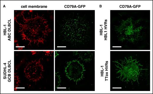 Figure 5. BCR clustering reflects type of BCR signaling in DLBCL lines. (A) Superresolution microscopy of BCR units, labeled by knock-in of CD79A-GFP fusion, in live cells imaged at the point of contact with glass coverslip chamber slides (bars represent 5 µm). Red CellMask dye marks the surface membrane. BCR units are clustered in the ABC-DLBCL line HBL-1, but diffusely distributed in the GCB-DLBCL line SUDHL-4. (B) SRM of BCR units in HBL-1 cells with CD79A-GFP fusion and dual HVR replacement. The BCR with endogenous HVRs remains clustered but is diffusely distributed when replaced with TTox-reactive HVRs.