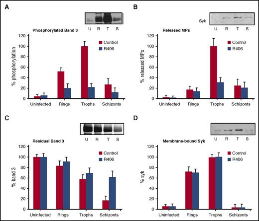 Figure 1. Abrogation of the P falciparum–induced erythrocyte membrane modifications by SYK inhibitors at different P falciparum lifecycle stages. Synchronized P falciparum cultures were supplemented with SYK inhibitor R406 (1.0 µM) at ring stage (24 hours after invasion). (A) Band 3 tyrosine phosphorylation levels are expressed as percentages of band 3 maximal phosphorylation measured at trophozoite stage and were normalized by the content of band 3 at each stage (% phosphorylation). The insert shows a representative western blot of tyrosine phosphorylated band 3 in the absence of inhibitors in uninfected RBCs (U); ring-infected RBCs (R); trophozoite-infected RBCs (T); and schizont-infected RBCs (S). (B) Number of MPs released from control and R406-treated cells. Values are expressed as a percentage of the maximal number of released MPs measured at trophozoite stage (% Released MPs). The insert shows a representative anti-Syk western blot of MPs released at different stages (U, R, T, S). (C) Band 3 content measured in control and R406-treated cells. Values are expressed as percentage of the band 3 measured at different stages using uninfected cells as reference (% band 3). The insert shows a representative western blot of band 3 at different stages (U, R, T, S). (D) Membrane-bound Syk measured in control and R406-treated cells. Values are expressed as a percentage of the maximal levels of bound Syk measured at trophozoite stage (% Syk). The insert shows a representative western blot of Syk at different stages (U, R, T, S). Data are the average of 6 independent experiments ± standard deviation (SD). Nitrocellulose membranes were stained with rabbit anti-Syk (Cell Signaling Technology, Inc., CA) diluted to 1:1000, and with goat anti-rabbit IRDye 800CW (LI-COR), diluted to 1:50 000. Quantitative densitometry analysis was performed using Odyssey V3.0 software. Photomicrographs were acquired using Odyssey from LI-COR, setting 300dpi as definition.