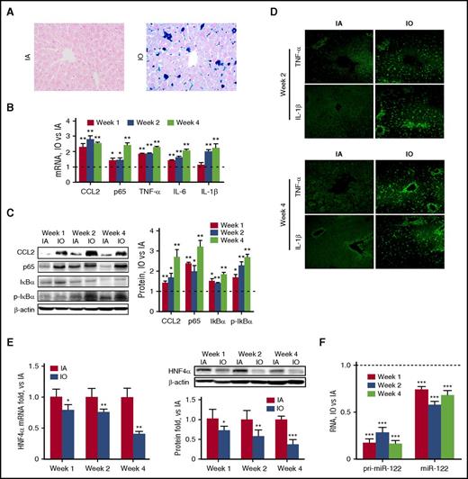 Figure 4. IO induces significant hepatic inflammation in vivo. C57BL/6 mice (N = 6) were fed a purified diet with no added iron and subjected to i.p. injection of 20 mg/kg (IA) or 200 mg/kg (IO) dextran-iron twice per week. Mice were sacrificed, and liver tissues were harvested at various time points. (A) Prussian blue staining shows heavy iron accumulation. Original magnification ×400. (B) RNA and (C) protein levels of various inflammatory factors were determined. (D) Immunofluorescence analysis showed upregulation of TNF-α and IL-1β expression. Original magnification ×200. (E-F) Expression of HNF4α at the mRNA and protein levels (E) and expression of miR-122 in the pri- and mature forms (F) were determined. Data were normalized to the IA group and are presented as mean ± SEM. *P < .05; **P < .01; ***P < .001 vs IA.