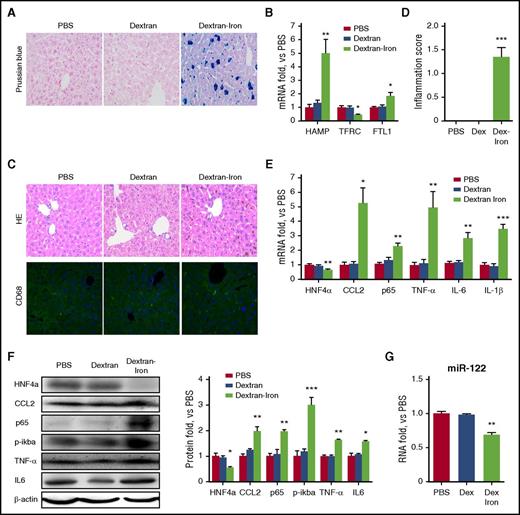 Figure 6. IO-induced hepatic inflammation is independent of macrophages. NOD/SCID mice (N = 6) were fed a standard diet and subjected to i.p. injection of 200 mg/kg (IO) dextran-iron twice per week. Mice were sacrificed, and liver tissues were harvested at week 4. (A) Prussian blue staining showed heavy iron accumulation. Original magnification ×400. (B) Total RNAs were subjected to qRT-PCR assays. (C) H&E and immunofluorescent staining against CD68 showed no macrophage infiltration in the liver. Blue represents DAPI stain. Original magnification ×400. (D) The inflammation scores of liver sections were determined. (E-F) Total RNA (E) and proteins (F) were subjected to qRT-PCR and western blot assays, respectively. (G) The level of mature miR-122 expression was determined. Data were normalized to the the PBS group and are presented as mean ± SEM. *P < .05; **P < .01 vs PBS.