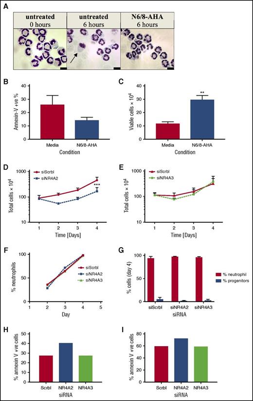 Figure 6. NR4A2 siRNA knockdown inhibits myeloid cell proliferation. Hoxb8 conditionally immortalized murine myeloid progenitor cells were subjected to estrogen withdrawal and differentiated to mature neutrophils (>90% maturity) in the presence of SCF and G-CSF for 4 days with daily media replenishment. (A-C) Mature neutrophils were incubated with or without N6/8-AHA (100 μM) for 6 hours in apoptosis medium. (A) Cell viability and apoptosis was visualized by oil immersion light microscopy (arrow denotes an apoptotic cell) and (B-C) quantified by flow cytometry. RNA interference transfections were conducted 1 day after estrogen withdrawal by using Amaxa Nucleofector technology. Cells were transfected with siRNA for NR4A2, NR4A3, or a nontargeting control (siScrbl) on day 1. Total cell numbers were determined by hemocytometer counts (D-E) at days 1, 2, 3, and 4. Neutrophil maturity was assessed by light microscopy (F-G). Apoptosis was measured on (H) day 4 and (I) day 5 by flow cytometry. Data are expressed as means ± SEMs; (B-C, G) n = 4), (D-E) n = 3, and (F, H-I) n = 1. Statistical analysis was performed by ANOVA with Bonferroni’s posttest. Significant differences to media controls or siScrbl transfected cultures were denoted by **P <.01 or ***P < .001, respectively.
