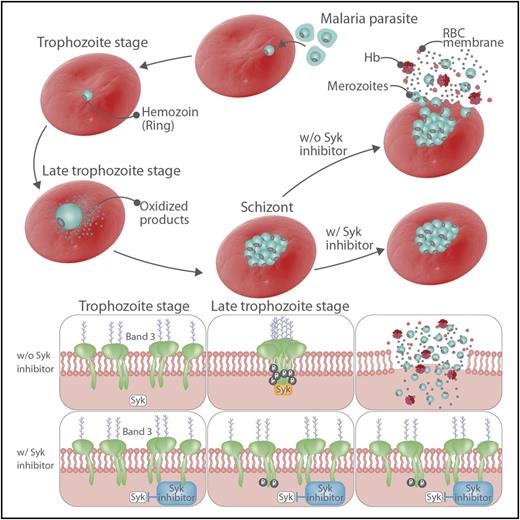 The role of band 3 in the life of the malarial parasite with (w/) and without (w/o) Syk tyrosine kinase inhibition. Hb, hemoglobin; p, phosphorylation of band 3; RBC, red blood cell. Professional illustration by Somersault18:24.