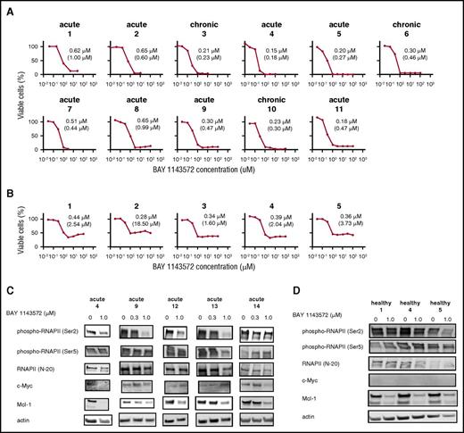 Figure 3. BAY 1143572 inhibits proliferation in primary ATL cells from patients. (A) The viabilities of primary ATL cells from 11 individual patients, in the presence of recombinant human IL-2 at a final concentration of 100 IU/mL and with different concentrations of BAY 1143572 for 24 hours, were assessed. Primary ATL cells were isolated from PBMCs (nos. 1-8, 10, 11) or the affected lymph node (no. 9) of ATL patients. The clinical subtype of each ATL patient is indicated above each panel. The IC50 value for primary cells of each ATL patient is indicated in each panel and was determined by a cell proliferation assay. The absolute IC50 value for each primary ATL cell line is also indicated in parentheses below the IC50 value. (B) The viabilities of human CD4+ cells from PBMCs of 5 healthy volunteers, in the presence of recombinant human IL-2 at a final concentration of 100 IU/mL and with different concentrations of BAY 1143572 for 24 hours, were assessed. The IC50 value for cells isolated from each healthy volunteer is indicated in each panel and was determined by a cell proliferation assay. The absolute IC50 value for each CD4+ cell line is also indicated in parentheses below the IC50 value. (C) Primary ATL cells from 5 individual patients, and (D) CD4+ cells obtained from 3 healthy volunteers were treated with the indicated concentrations of BAY 1143572 for 12 hours, and western blotting was performed. Blots were probed with antibodies to phospho-RNAPII (Ser2), phospho-RNAPII (Ser5), RNAPII (N-20), c-Myc, and Mcl-1. Actin was used as a loading control.