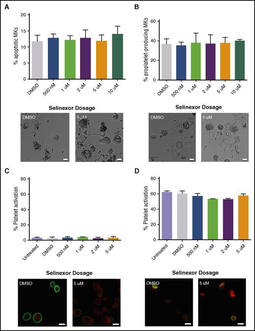 Figure 2. Selinexor does not affect MK apoptosis, proplatelet formation, or platelet activation. (A-B) Mature, round mouse MKs derived from murine fetal livers were treated with increasing doses of selinexor. Six hours later, viability of the MKs and the number of proplatelet-producing MKs were quantified. Bars represent 20 μm; n = 3. Mature donor human platelets were treated with increased concentrations of selinexor in the absence (C) or the presence (D) of thrombin, and platelet surface P-selectin was analyzed by fluorescence-activated cell sorter (FACS). Representative images of resting (C) and activated (D) platelets stained with actin (phalloidin, red) and anti-β1-tubulin antibody (green). Bars represent 2 μm; n = 3. DMSO, dimethyl sulfoxide.