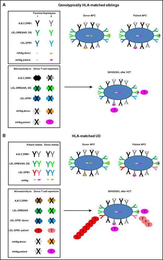 Figure 1. Molecular targets of GVHD and GVL after HCT from HLA-matched siblings or UD. HLA molecules and mHAg peptides are depicted as Y or bars, and APCs and T cells as large or small oval shapes, respectively. T cells that undergo positive or negative selection in the thymus are labeled with a T or an X, respectively. Self-peptides presented by HLA molecules on the surface of an APC are indicated with gray dots; mHAg peptides are indicated with orange or pink dots. (A) Genotypically HLA-matched siblings. In the left top box, the 2 parental HLA haplotypes are schematically represented, along with 2 examples of mHAgs of which 1 is shared (gray bars) and the other is not shared (orange and pink bars) by the 2 siblings. In the bottom box, the T-cell repertoire of the sibling donor after thymic education is shown. Self-reactive T cells against HLA molecules have been clonally deleted by negative selection, whereas T cells alloreactive to the unshared mHAg (pink T cells) have undergone positive selection and mediate GVHD and/or GVL after HLA-matched sibling HCT. (B) HLA-matched UD. The top box shows the HLA component of a typical 10 of 10 UD-recipient pair matched for both HLA-A, -B, -C-DRB1 alleles (in black and gray) as well as for the LEL-DRB3/4/5 and -DQ (in dark and light green), but mismatched for both LEL-DPB1 alleles (in dark and light blue and red, respectively). Moreover, in this example, patient and donor are mismatched for the same mHAg as in panel A. The bottom box shows the donor T-cell repertoire after positive and negative selection, which contains T cells alloreactive not only to mismatched mHAgs but also to both mismatched LEL-DPB1 alleles. In this example, 1 of the 2 mismatched HLA-DPB1 alleles is nonpermissive (dark red) whereas the other one is permissive (light red), giving rise to direct T-cell responses of different magnitude but generally stronger than the response to mHAg mismatches. Together, these alloreactive T cells mediate GVHD and/or GVL after HLA-matched UD-HCT.
