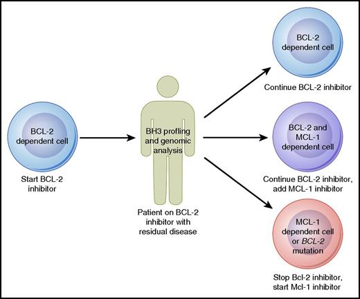 Figure 3. Model for how BH3 profiling and genomic analysis could help guide therapy with agents targeting the BCL-2 family of proteins in B-cell lymphomas. Professional illustration by Patrick Lane, ScEYEnce Studios.