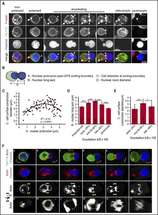 Figure 1. Mouse FL erythroblast enucleation is characterized by dumbbell-shaped nuclear morphology and prominent F-actin foci at the cell surface constriction and at the rear of the translocating nucleus. (A) Extended-focus projections of confocal Z-stacks of mouse FL erythroblasts at various stages of enucleation immunostained for Ter119, phalloidin for F-actin, and Hoechst for nuclei. Arrows, bright F-actin spot in polarized cells and at the rear of the translocating nucleus opposite its membrane point of contact. Open arrowheads, F-actin cap at the site of nuclear contact with the membrane in a polarized cell. Closed arrowheads, F-actin foci at the cell surface constriction in enucleating cells, connecting to fine F-actin cables extending over the nuclear protrusion. Dashed lines, Ter119 membrane sorting boundary. Bar, 4 µm. (B) Schematic representation of quantitative image analysis of nuclear and cell surface constriction geometry in mouse FL enucleating erythroblasts. (C) Scatter plot of cell surface constriction diameter plotted as a function of nuclear protrusion for erythroblasts at all stages of nuclear expulsion. Parabolic regression was applied to the data (P < .0001). (D) Bar graph of nuclear long axis plotted as a function of nuclear protrusion for erythroblasts binned according to extent of enucleation. ***P < .001. (E) Bar graph of the cell surface constriction diameter size for erythroblasts binned according to extent of enucleation. *P < .05; ***P < .001. Images for quantification of FL erythroblasts were obtained from 133 confocal Z-stacks of cells obtained from 23 embryos (12 different litters). A total of 128 polarized or enucleating cells were analyzed. One hundred two enucleating cells with protruding nuclei were analyzed in panel C and separated into mid, early, and late enucleation stages for panels D-E. Numbers (n) of polarized or enucleating (mid, early, late) cells, or pyrenocytes, indicated on bars in panels D and E. (F) 3D reconstructions of confocal Z-stacks of (a-f) mouse FL erythroblasts at various stages of enucleation immunostained for Ter119, phalloidin for F-actin, and Hoechst for nuclei. Also shown is F-actin at the Ter119-sorting boundary, defined by yellow brackets, of (a′-f′) erythroblasts rotated 90° around the axis running perpendicular to the direction of nuclear expulsion, providing a view through the neck of the enucleating erythroblast. Dashed yellow lines demarcate location of the nuclear perimeter in the neck region. In erythroblasts beginning to enucleate or nearly completely enucleated with smaller constriction diameters, F-actin completely surrounds the nucleus beneath the cell surface constriction (b′, e′). In erythroblasts with larger constriction diameters, F-actin exhibits small gaps (c′) and/or large F-actin–free regions (d′). 3D grid dimensions are as indicated on each image for A-F.