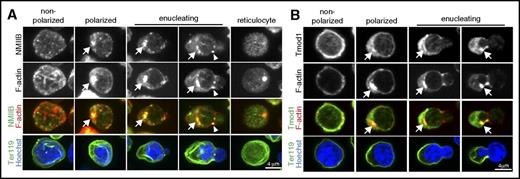 Figure 2. F-actin is associated with NMIIB and Tmod1 in mouse FL enucleating erythroblasts. (A) Extended-focus projections of confocal Z-stacks of mouse FL erythroblasts at various stages of enucleation immunostained for NMIIB and Ter119, phalloidin for F-actin, and Hoechst for nuclei. Arrows, bright F-actin/NMIIB spot at the rear of the translocating nucleus. Arrowheads, F-actin/NMIIB at cell surface constriction site. (B) Confocal single optical sections of mouse FL erythroblasts at various stages of enucleation immunostained for Tmod1 and Ter119, phalloidin for F-actin, and Hoechst for nuclei. Arrows, F-actin/Tmod1 cytoplasmic spot. Bars, 4 µm.
