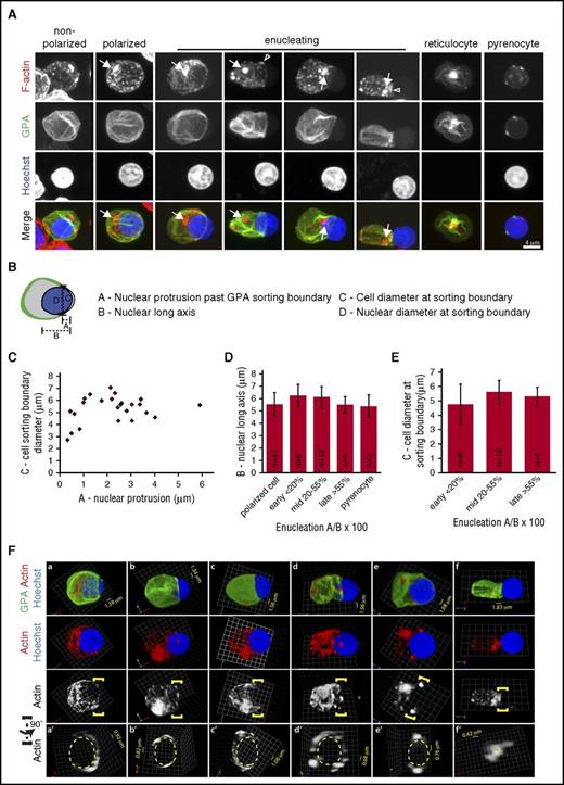Figure 3. Human bone marrow erythroblast enucleation is characterized by spherical nuclear morphology and prominent F-actin spots at the rear of the translocating nucleus. (A) Extended-focus projections of confocal Z-stacks of human bone marrow erythroblasts at various stages of enucleation were immunostained for GPA, phalloidin for F-actin, and Hoechst for nuclei. Arrows, prominent cytoplasmic F-actin spots. Arrowheads, small F-actin spot at GPA sorting boundary. Bar, 4 µm. (B) Schematic representation of quantitative image analysis of the geometry of the cell and nucleus at the GPA-sorting boundary. (C) Scatterplot of cell diameter at GPA-sorting boundary plotted as a function of nuclear protrusion for erythroblasts at all stages of nuclear expulsion. No significant correlation was observed. (D) Bar graph of nuclear long axis plotted as a function of extent of nuclear protrusion past the GPA-sorting boundary for erythroblasts binned according to extent of enucleation. The long axis of the nucleus remains unchanged during enucleation. (E) Bar graph of cell diameter at GPA-sorting boundary plotted as a function of nuclear protrusion for erythroblasts binned according to extent of enucleation. Diameter of the GPA-sorting membrane boundary remains constant and is the size of the nucleus. The nucleus does not need to deform to pass through this opening during expulsion from human erythroblasts. Images for quantification of human erythroblasts were obtained from 73 confocal Z-stacks of cells obtained from 6 separate human bone marrow samples. A total of 71 polarized or enucleating cells were analyzed. Twenty-four enucleating cells with protruding nuclei were analyzed in panel C and separated into mid, early, and late enucleation stages for panels D-E. Numbers (n) of polarized or enucleating (mid, early, late) cells or pyrenocytes indicated on bars in panels D and E. (F) 3D reconstructions of confocal Z-stacks of (a-f) human bone marrow erythroblasts at various stages of enucleation immunostained for GPA, phalloidin for F-actin, and Hoechst for nuclei. Also shown is F-actin in regions, defined by yellow brackets, of (a′-f′) human bone marrow erythroblasts rotated 90° around the axis running perpendicular to the direction of nuclear expulsion, providing a view through the “neck” of the enucleating erythroblast. Dashed yellow lines demarcate location of the nuclear perimeter at the GPA-sorting boundary. Few, small puncta of F-actin are associated with the sorting boundaries of the enucleating erythroblasts. 3D grid dimensions are as indicated.