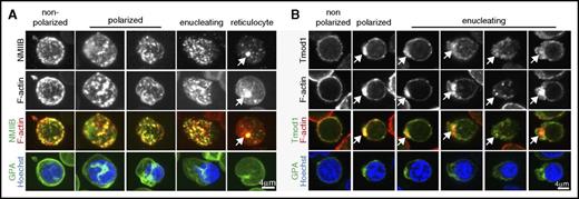 Figure 4. F-actin is associated with NMIIB and Tmod1 in human enucleating erythroblasts. (A) Extended-focus projections of confocal Z-stacks of human bone marrow erythroblasts at various stages of enucleation immunostained for NMIIB and GPA, phalloidin for F-actin, and Hoechst for nuclei. (B) Confocal single optical sections of human bone marrow erythroblasts at various stages of enucleation immunostained for Tmod1 and GPA, phalloidin for F-actin, and Hoechst for nuclei. Arrows, bright F-actin spots at the rear of the translocating nucleus and in the reticulocyte. Bar, 4 µm.
