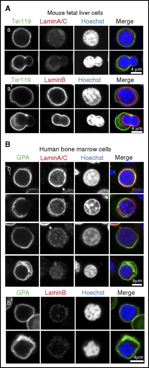 Figure 5. Lamin B but not Lamin A/C is expressed in mouse FL erythroblasts, whereas human bone marrow erythroblasts have variable expression of Lamin A/C but no Lamin B. (A) Confocal single optical sections showing mouse FL erythroblasts immunostained for (a) Lamin A/C, or (a′) Lamin B along with Ter119 and Hoechst. (B) Confocal single optical sections of human bone marrow cells immunostained for (b) Lamin A/C or (b′) Lamin B along with GPA and Hoechst. Bars, 4 µm.