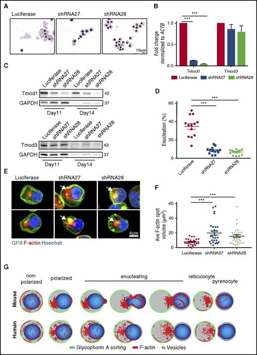 Figure 7. TMOD1 knockdown during human erythroblast differentiation impairs enucleation and increases the amount of cytoplasmic F-actin in polarized erythroblasts. CD34+ cells were transduced with either luciferase (control) or TMOD1 (shRNA27 or shRNA28) lentivirus and induced toward erythroid differentiation. Puromycin selection was performed 48 hours posttransduction. (A) Wright Giemsa–stained cytospins of CD34+ cells at day 14. Bar, 10 µm. (B) Quantitative reverse transcription polymerase chain reaction of TMOD1 and TMOD3 levels normalized to ACTB in Luciferase control or TMOD1 knockdown. ***P < .001 (N = 3). (C) Representative western blot for Tmod1 and Tmod3 and glyceraldehyde-3-phosphate dehydrogenase (GAPDH) at day 11 and day 14 of differentiation. (D) Late orthochromatic erythroblast populations were flow sorted at day 16 based on the surface expression levels of GPA, α4-integrin, and Band3. SYTO60 was used to measure enucleation within these populations. ***P < .001. (E) Extended-focus projections of confocal Z-stacks of polarized, differentiated CD34+ cells (control or TMOD1 knockdown), immunostained for GPA, phalloidin for F-actin, and Hoechst for nuclei. Arrows show increased size of cytoplasmic F-actin spot in TMOD1 knockdown cells. Bar, 4 µm. (F) Average F-actin spot volume in polarized, or enucleating differentiated CD34+ cells in panel E. ***P < .001. N = 26 cells for Luciferase control, 29 for shRNA27, and 32 for shRNA28, obtained from 2 separate knockdown experiments. (G) Schematics of GPA sorting (green), F-actin reorganization (red), and nuclear (blue) expulsion during the progression of mouse and human erythroblast enucleation. In both mouse and human erythroblasts, the F-actin network undergoes dramatic reorganization during enucleation. As the erythroblasts polarize, an F-actin spot (the enucleosome) appears at the rear of the nucleus. The enucleosome follows the translocating nucleus and may drive expulsion. Mouse erythroblast nuclei adopt a dumbbell-shaped morphology during expulsion, with prominent F-actin foci associated with the cell surface and nuclear constriction at the Ter119-sorting boundary, whereas human erythroblast nuclei retain a spherical morphology, and only very small F-actin foci are present at the GPA-sorting boundary over the translocating nucleus. Small membrane vesicles are depicted near the rear of the translocating nucleus, based on our (eg, supplemental Figure 3B) and others’ observations.11,18 For simplicity, microtubules are not depicted.