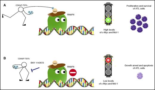 Inhibition of CDK9 signaling with the novel agent BAY 1143572 abrogates proliferation and induces apoptosis of ATL cells. (A) CDK9 phosphorylates RNA polymerase II (RNAPII) at serine 2 resulting in high levels of c-Myc and Mcl-1 and leading to proliferation and survival of ATL cells. (B) BAY 1143572 specifically inhibited CDK9-mediated phosphorylation at serine 2 of RNAPII resulting in decreased levels of c-Myc and Mcl-1, thus leading to growth arrest and apoptosis of ATL cells.