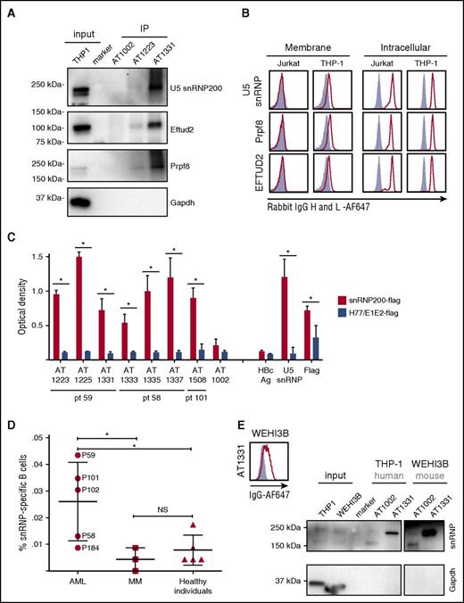 Figure 2. Target identification of AML-specific antibodies: U5 snRNP200 complex. (A) Immunoblotting of THP-1 immunoprecipitates (IP) with AT1223, AT1331, and AT1002 with rabbit snRNP200–, PRPF8–, and EFTUD2– and mouse GAPDH–specific antibodies. (B) Jurkat and THP-1 cells were stained with a commercially available rabbit anti-PRPF8 (Abcam), -snRNP200 (Bethyl Labs), and -EFTUD2 (Abcam) antibodies on the membrane (left panels) and intracellularly (right panels). Polyclonal rabbit antihepatitis core antigen (HBcAg) was used as negative control (gray-filled histograms). (A-B) Depicted is 1 representative experiment of at least 3 independent experiments (Table 2). (C) Seven AML-specific antibodies recognize the U5 snRNP200 complex, as tested in ELISA. Depicted are means of 3 independent experiments and standard deviations. Flag-tagged hepatitis C–specific protein (H77/E1/E2-flag) was used as a negative control. SnRNP200, commercially available rabbit anti-snRNP200; snRNP200-flag, flag-tagged snRNP200 lysate; AT1002, influenza-specific antibody. *P < .003. (D) Screening of 20 cells per well cultures of 5 allogeneic HSCT recipients with lasting anti-AML responses (AML), 3 patients with multiple myeloma (MM) in long-time remission after allogeneic HSCT, and 5 healthy individuals for antibodies binding to snRNP200 (ELISA). In total, 23.040 B cells per patient were screened. NS, not significant. (E) Immunoblotting of THP-1 (human AML) and WEHI-3B (mouse AML) immunoprecipitates with AT1331 and AT1002 with rabbit snRNP200– and mouse GAPDH–specific antibodies. Specific U5 snRNP200 complex stain is seen for both human and mouse AML cells. (Right panel) Binding of AT1331 to WEHI-3B cells.