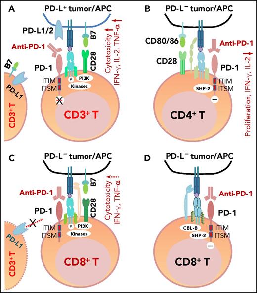Figure 3. The mechanism of action of PD-1 blockade in PD-L+ tumors and models of potential functional effects of anti-PD-1 therapy on PD-1+ T cells (CD4+/CD8+) in patients without PD-L expression (PD-L–), according to the literature. (A) In PD-L+ tumors, the antigen-specific T-cell response is inhibited because PD-1 is engaged by PD-L1/2. PD-1 blockade with anti-PD-1 antibodies prevents PD-L1/PD-L2 from interacting with PD-1 and restores T-cell function (anti-PD-1 mAb acting as an antagonist). (B) In PD-L– tumors with PD-1+CD4+ T-cell infiltrate, according to Chemnitz et al80 and Bennett et al,122 PD-1 ligation with PD-1 antibodies inhibits CD4+ T-cell proliferation and cytokine production under suboptimal CD3 and CD28 costimulation conditions (anti-PD-1 mAb acting as a PD-1 agonist), which are caused by inhibition of TCR downstream signaling mediated by SHP-2 associated with immunoreceptor tyrosine-based switch motif (ITSM) of PD-1. It is unknown whether this scenario is relevant for some hyperprogressive diseases after PD-1 blockade therapy. (C) The effect of anti-PD-1 antibodies on PD-1+CD8+ T cells in PD-L– tumors is unknown. If the TCR signaling is strong with optimal CD28 costimulation and/or TCR engagement (in which case, PD-L– is likely caused by mutations or lack of IFN-γ receptor on PD-L– tumors, but not because of lack of IFN-γ release), PD-1 ligation with anti-PD-1 antibodies may have no significant effect on the high CD8+ T cell function.2,122 Furthermore, if circulating activated T cells express PD-L1 and the PD-1−PD-L1 axis suppresses PD-1+ or PD-L1+ T-cell function, PD-1 blockade could enhance CD4+/CD8+ T-cell function, thereby manifesting clinical activity in these PD-L– patients. (D) As another possibility for anti-PD-1 therapy in PD-L– tumors, engagement of PD-1 on CD8+ T cells by PD-1 antibodies could inhibit TCR signaling (acting as a PD-1 agonist) similar to ligation with the natural ligand PD-L1, mediated by SHP-2 phosphatase activity and TCR internalization/degradation as a result of increased CBL-b ubiquitin ligase activity.123 ITIM, immunoreceptor tyrosine-inhibitory motif.