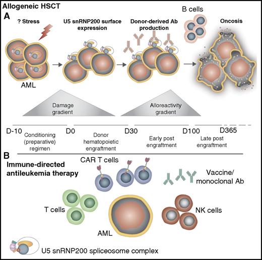 (A) Potential schematic for antibody-specific induction of oncosis in AML following allogeneic HSCT. Normally located within the cytoplasm and nucleus, the spliceosome complex U5 snRNP200 becomes expressed on the cell surface of AML blasts via an undefined cell stress–inducible factor and mechanism for antigen processing and presentation. Damage and alloreactivity gradients associated with allogeneic HSCT may provide the necessary cellular stress in leukemic blasts to instigate this process. Cell surface expression of the spliceosome complex enables donor-derived antibody production specific to the U5 snRNP200 complex, resulting in leukemia cell injury characterized by cytoskeleton disruption and pore formation and subsequent extravasation of intracellular contents and ultimate leukemia cell demise (oncosis). (B) Emerging immune-directed therapy targeting AML. CAR T cells9 as well as other alternative forms of T-cell therapies10 could be engineered and/or expanded ex vivo to target preferential antigen expression on AML blasts like the U5 snRNP200 complex. NK cells used in the setting of killer cell immunoglobulin-like receptor mismatch allogeneic HSCT can be expanded and potentially engineered to target AML-specific receptors. Monoclonal antibodies, including gemtuzumab ozogamicin (anti-CD33), target AML blasts, and vaccination strategies incorporating AML-specific antibodies could also be considered. Ab, antibody.